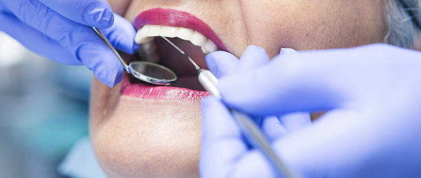 Best Emergency Dental Care for Broken or Chipped Teeth in Millbrook, AL